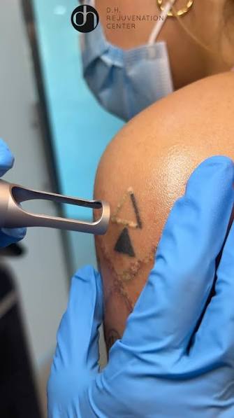 Tatuajes